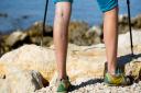 Varicose veins can be painful