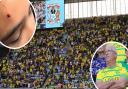 Norwich fans, including Canaries Trust chairman Robin Sainty, have widely criticised the person who threw a coin which hit an 11-year-old Coventry fan